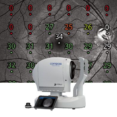 iCare COMPASS Perimetre