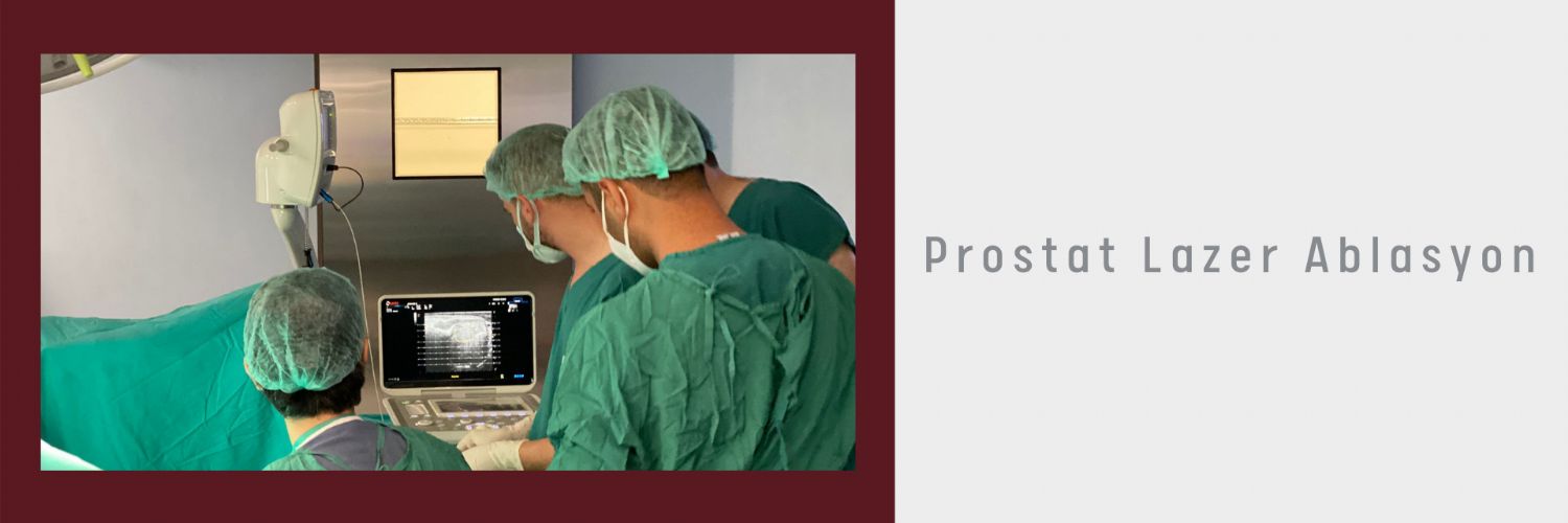 Perineal Prostat Lazer Ablasyon