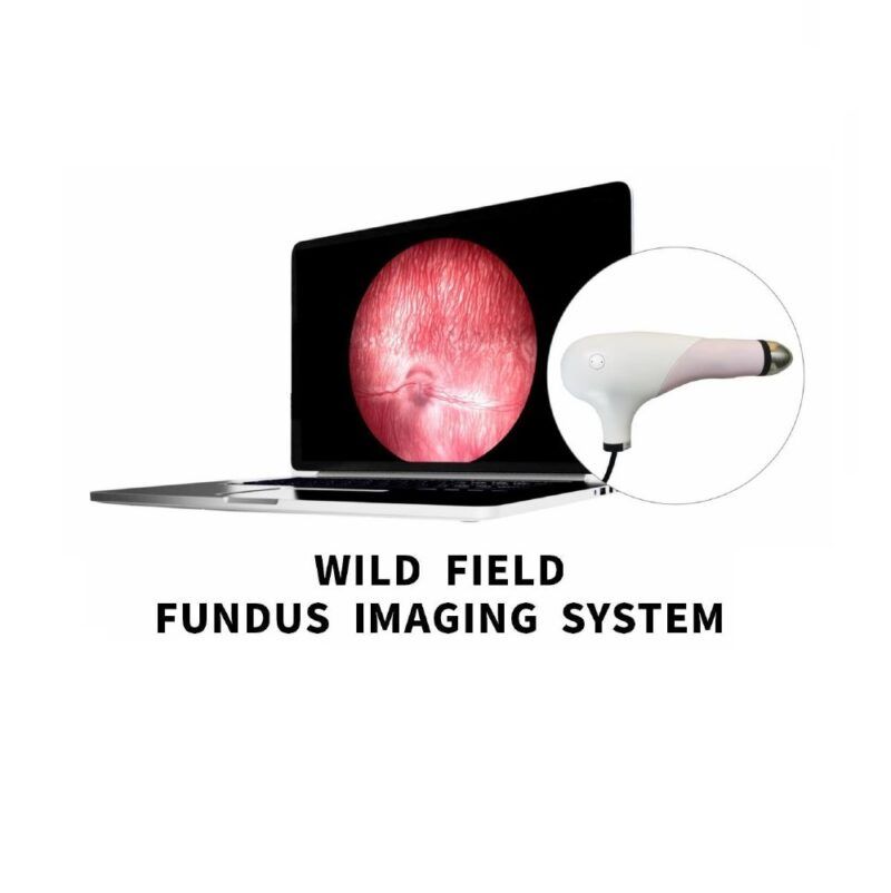 SK-8000A/B/C Geni� Alan Retina Kameras� (ROP)